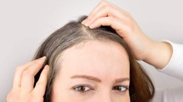 اكتشاف :لماذا يؤدي التوتر إلى تحول الشعر للون الأبيض؟