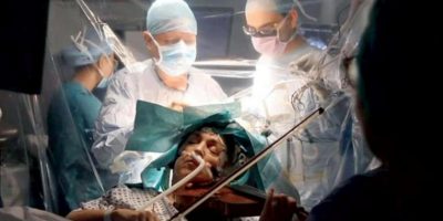 مريضة تعزف الكمان أثناء خضوعها لجراحة استئصال ورم في المخ مريضة تعزف الكمان أثناء خضوعها لجراحة استئصال ورم في المخ