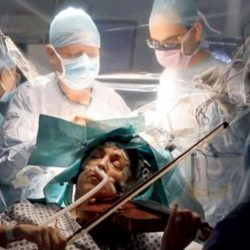 مريضة تعزف الكمان أثناء خضوعها لجراحة استئصال ورم في المخ