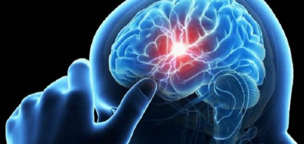 خبير قلوب ينصح باتباع 6 عادات للوقاية من الجلطة الدماغية
