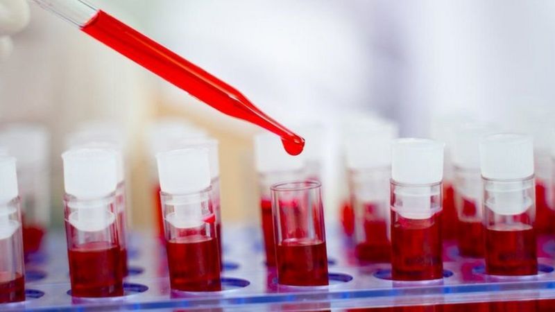 الإيدز: حالة نادرة لسيدة أرجنتينية تهزم الفيروس وتطرده من جسدها بدون علاج